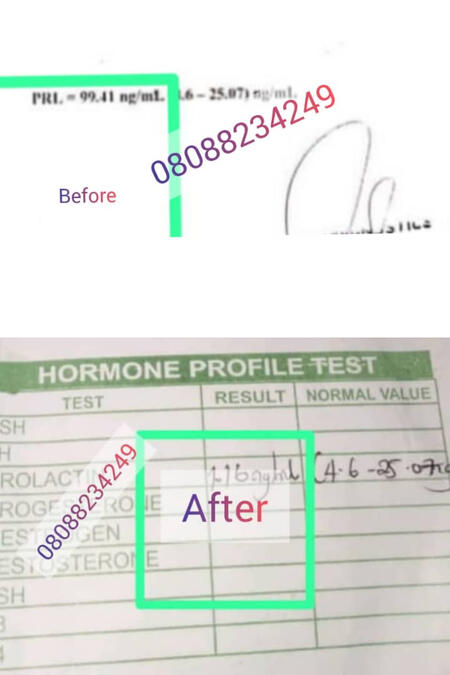 2 in 1 combo for couples. Enhance sperm and egg quality with a convenient preconception pack for males and females. Optimize fertility naturally."