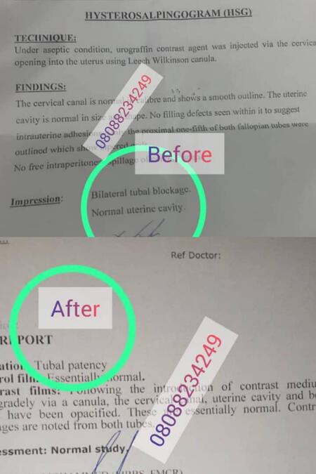 2 in 1 combo for couples. Enhance sperm and egg quality with a convenient preconception pack for males and females. Optimize fertility naturally."